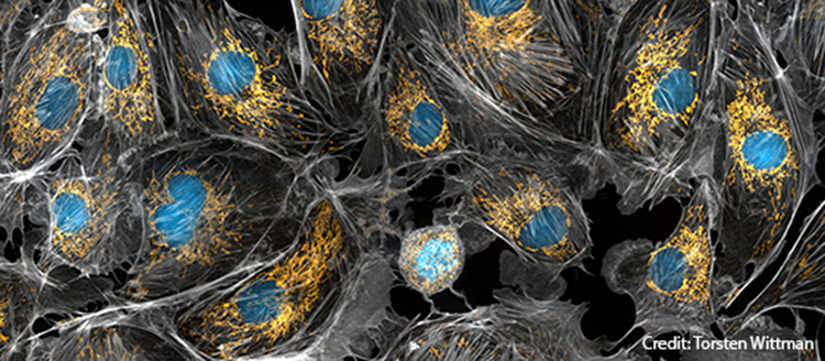 mitochondria